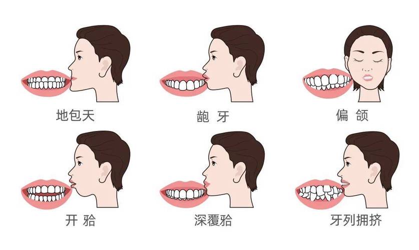 正确口咬的方法图片