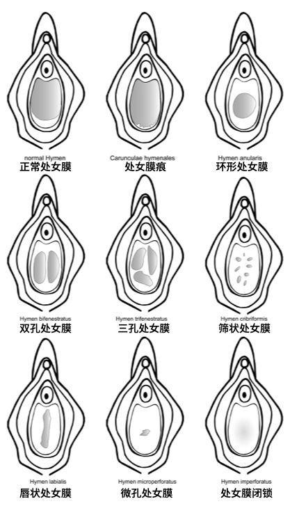  处破女处破全过第一次：探讨青春与成长的印记